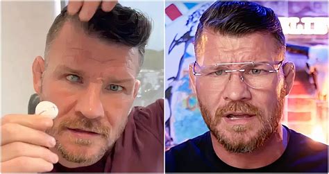 michael bisping vs gsp|what's wrong with bisping's eye.